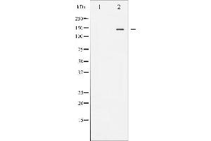 Western blot analysis of eNOS phosphorylation expression in Insulin treated HeLa whole cell lysates,The lane on the left is treated with the antigen-specific peptide.