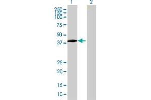 Western Blot analysis of ZNF547 expression in transfected 293T cell line by ZNF547 MaxPab polyclonal antibody. (ZNF547 anticorps  (AA 1-402))