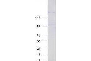 Validation with Western Blot