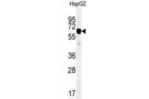 Western Blotting (WB) image for anti-Insulin-Like Growth Factor 2 mRNA Binding Protein 2 (IGF2BP2) antibody (ABIN2995531) (IGF2BP2 anticorps)