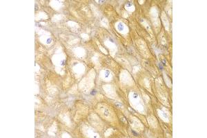 Immunohistochemistry of paraffin-embedded human esophagus using ACTN1 antibody (ABIN5970506) at dilution of 1/100 (40x lens).