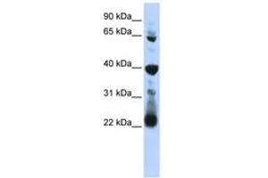 Image no. 1 for anti-RNA Pseudouridylate Synthase Domain Containing 3 (RPUSD3) (AA 251-300) antibody (ABIN6743049)