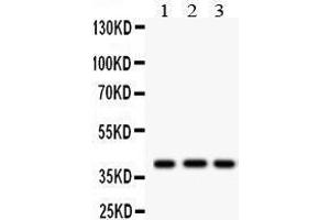 Anti- HLA-A Picoband antibody, Western blotting All lanes: Anti HLA-A  at 0. (HLA-A anticorps  (N-Term))