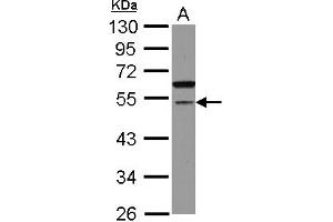 Western Blotting (WB) image for anti-Cell Division Cycle Associated 7-Like (CDCA7L) (AA 184-397) antibody (ABIN1497406) (CDCA7L anticorps  (AA 184-397))