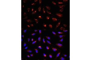 Immunofluorescence analysis of U-2 OS cells using GCSH Rabbit pAb (ABIN6127983, ABIN6141032, ABIN6141033 and ABIN6217784) at dilution of 1:100 (40x lens).