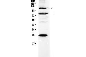 Western blot analysis of NFAT4 using anti-NFAT4 antibody . (NFATC3 anticorps  (AA 630-712))