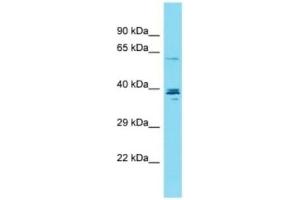 Host: Rabbit , Target: CCDC149,  Sample Type: OVCAR-3 Whole Cell Lysates,  Antibody Dilution: 1. (CCDC149 anticorps  (C-Term))
