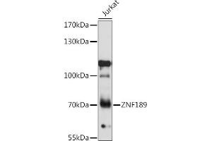 anti-Zinc Finger Protein 189 (ZNF189) (AA 1-150) antibody