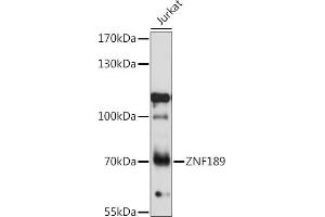 Western blot analysis of extracts of Jurkat cells, using ZNF189 antibody (ABIN7271463) at 1:1000 dilution. (ZNF189 anticorps  (AA 1-150))