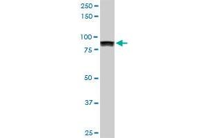UBTF monoclonal antibody (M02), clone 6C6.