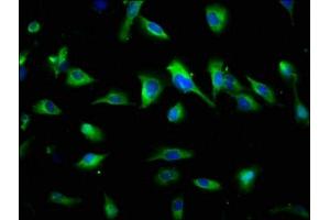 Immunofluorescence staining of U251 cells with ABIN7171138 at 1:145, counter-stained with DAPI.