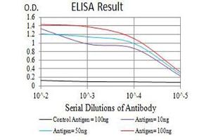 Black line: Control Antigen (100 ng),Purple line: Antigen (10 ng), Blue line: Antigen (50 ng), Red line:Antigen (100 ng)