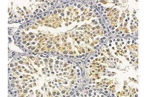 Flt3/CD135 Mouse Monoclonal Antibody at 1/100 staining mouse testis tissue by IHC-P. (FLT3 anticorps  (C-Term))