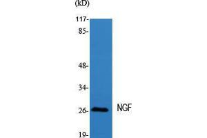 Western Blot (WB) analysis of specific cells using NGF Polyclonal Antibody. (Nerve Growth Factor anticorps  (Internal Region))