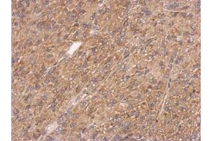 IHC-P Image Immunohistochemical analysis of paraffin-embedded U87 xenograft, using calponin 3, antibody at 1:500 dilution.