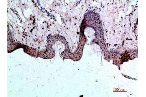 Immunohistochemical analysis of paraffin-embedded human-skin, antibody was diluted at 1:200 (BMP1 anticorps  (AA 131-180))