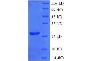 SDS-PAGE (SDS) image for Interleukin 2 Receptor, beta (IL2RB) (AA 24-240), (Extracellular) protein (His tag) (ABIN5713558)