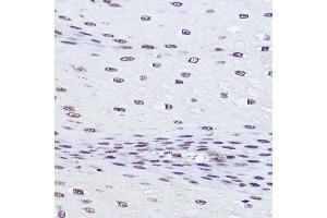 Immunohistochemistry of paraffin-embedded human esophageal using POLR2A Rabbit pAb (ABIN6130298, ABIN6145914, ABIN6145915 and ABIN6215095) at dilution of 1:50 (40x lens). (POLR2A/RPB1 anticorps  (AA 1-260))
