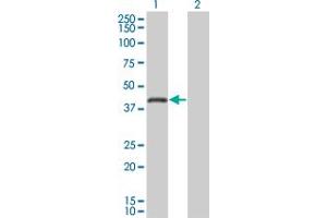 Western Blot analysis of RNF26 expression in transfected 293T cell line by RNF26 monoclonal antibody (M01), clone 5B9. (RNF26 anticorps  (AA 344-433))
