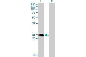 Western Blot analysis of BIN3 expression in transfected 293T cell line by BIN3 monoclonal antibody (M02A), clone 1H8. (BIN3 anticorps  (AA 1-199))