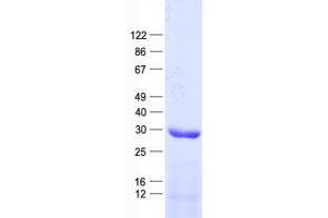 Validation with Western Blot