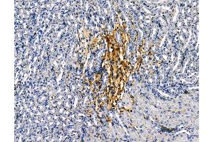 ABIN6260453 and ABIN6279232 at 1/100 staining mouse kidney tissue by IHC-P. (CAPNS2 anticorps  (Internal Region))