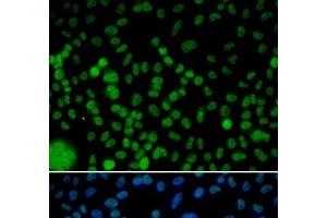Immunofluorescence analysis of HeLa cells using IRF2 Polyclonal Antibody (IRF2 anticorps)