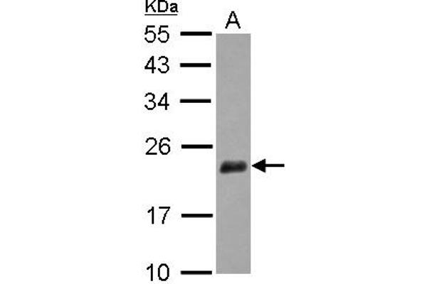 NUDT3 anticorps  (AA 1-172)