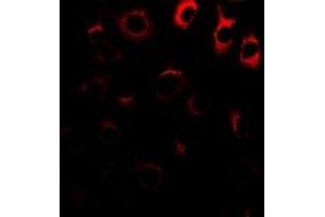 Immunofluorescent analysis of NRAGE staining in A549 cells. (MAGED1 anticorps)