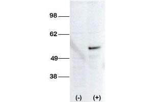 Image no. 2 for anti-serine/threonine Kinase 38 Like (STK38L) (C-Term) antibody (ABIN360006) (STK38L anticorps  (C-Term))