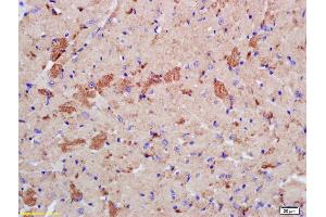 Formalin-fixed and paraffin embedded mouse heart labeled with Rabbit Anti phospho-LATS2 (Ser83) Polyclonal Antibody, Unconjugated (ABIN753568) at 1:200 followed by conjugation to the secondary antibody and DAB staining