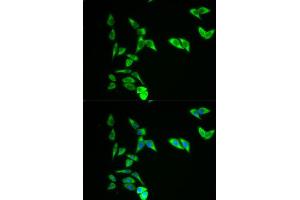 Immunofluorescence analysis of A549 cell using AK1 antibody.