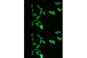 Immunofluorescence analysis of A549 cell using AK1 antibody. (Adenylate Kinase 1 anticorps  (AA 1-194))