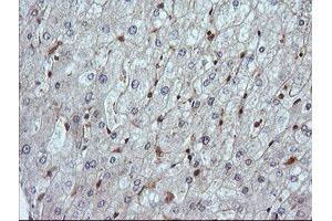 Image no. 2 for anti-Leucine Zipper and CTNNBIP1 Domain Containing (LZIC) antibody (ABIN1499239)