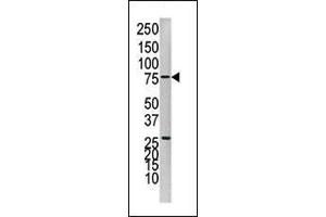 Western blot analysis of anti-PTP1B Pab (ABIN1882122 and ABIN2842257) in Jurkat cell line lysate.