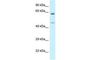 Image no. 1 for anti-Asparaginyl-tRNA Synthetase (NARS) (AA 43-92) antibody (ABIN6747536) (NARS anticorps  (AA 43-92))