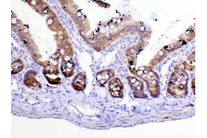 IHC analysis of beta Catenin using anti-beta Catenin antibody .
