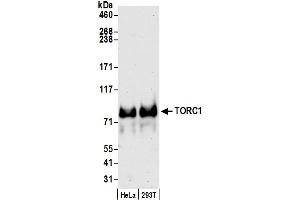 Western Blotting (WB) image for anti-CREB Regulated Transcription Coactivator 1 (CRTC1) (C-Term) antibody (ABIN7453901) (CRTC1 anticorps  (C-Term))