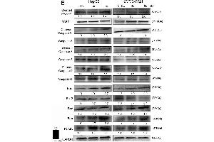 Erianin induced mitochondrial apoptosis in liver cancer cells. (BIM anticorps  (AA 51-150))