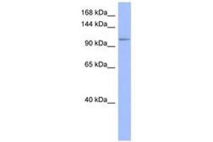 Image no. 1 for anti-MutS Homolog 4 (E. Coli) (MSH4) (AA 863-912) antibody (ABIN6741641) (MSH4 anticorps  (AA 863-912))