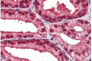 Human Prostate (formalin-fixed, paraffin-embedded) stained with NOTCH4 antibody ABIN462184 followed by biotinylated goat anti-rabbit IgG secondary antibody ABIN481713, alkaline phosphatase-streptavidin and chromogen.