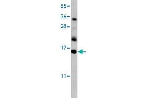 Western blot analysis of mouse kidney tissue lysate (35 ug/lane) with HRK polyclonal antibody . (HRK anticorps  (AA 30-50))