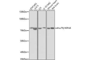 Western blot analysis of extracts of various cell lines, using (ABIN3016123, ABIN3016124, ABIN3016125 and ABIN6219558) at 1:1000 dilution. (Hsc70 anticorps  (AA 1-300))