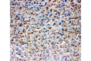 IHC-P testing of rat liver tissue (HSD17B1 anticorps  (AA 29-43))