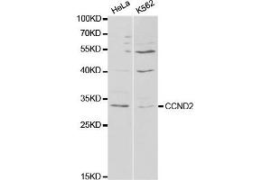 Western Blotting (WB) image for anti-Cyclin D2 (CCND2) antibody (ABIN1875413)