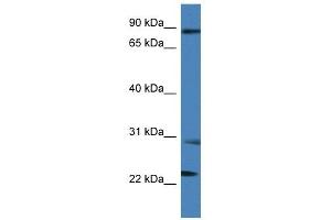 Western Blot showing MIA2 antibody used at a concentration of 1 ug/ml against THP-1 Cell Lysate (MIA2 anticorps  (C-Term))