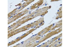 Immunohistochemistry of paraffin-embedded Rat heart using ATP5B Polyclonal Antibody at dilution of 1:100 (40x lens). (ATP5B anticorps)