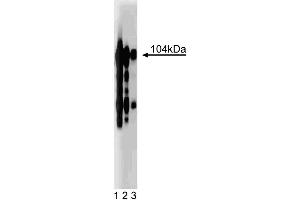 Western blot analysis of Intergrin beta3 on a human platelet lysate.
