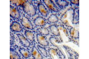 Used in DAB staining on fromalin fixed paraffin-embedded bowels tissue (TMSB4X anticorps  (AA 1-44))