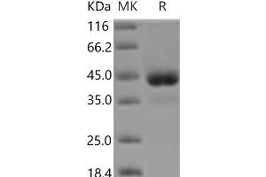 Western Blotting (WB) image for Activin Receptor Type I (ACRV1) protein (Fc Tag) (ABIN7194131) (ACVR1 Protein (Fc Tag))